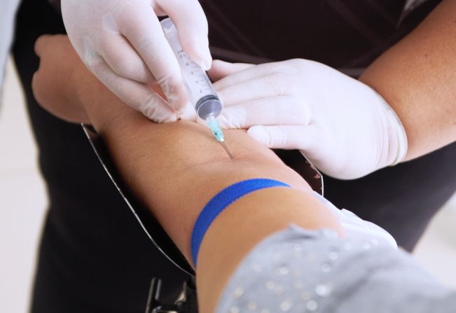  Mutirão “ZERA FILA” de exames laboratoriais.